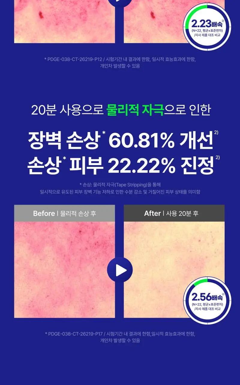 [색소침착 / 진정장벽케어]이지듀 EGFx 다운타임 크림 60ml 기획(+오인트 겔 5ml) 상세페이지 20